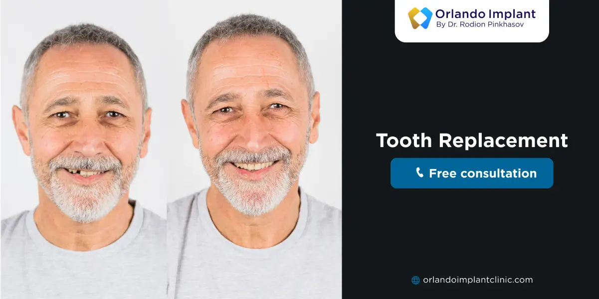 Tooth Replacement Options
